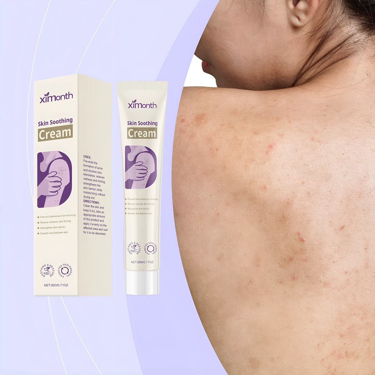 20g herbal acne care cream for external body care and smooth skin rejuvenation