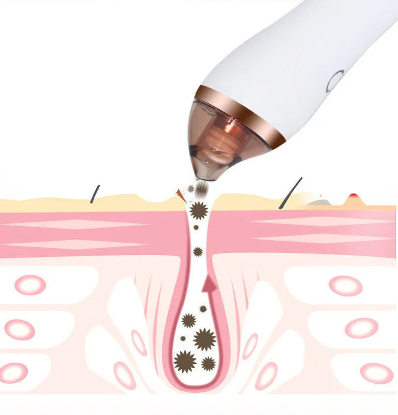 4 in 1 guasha cupping blackhead remover machine with suction heads and USB cable