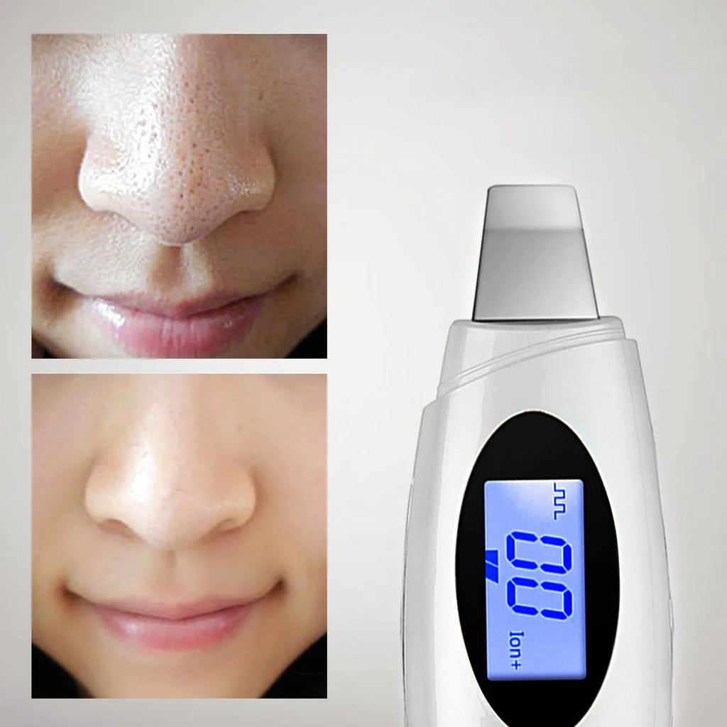 Ultrasonic beauty instrument star silver with adjustable vibration frequency and charging cable