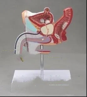 Anatomical male reproductive system pathology model showing detailed disease structures