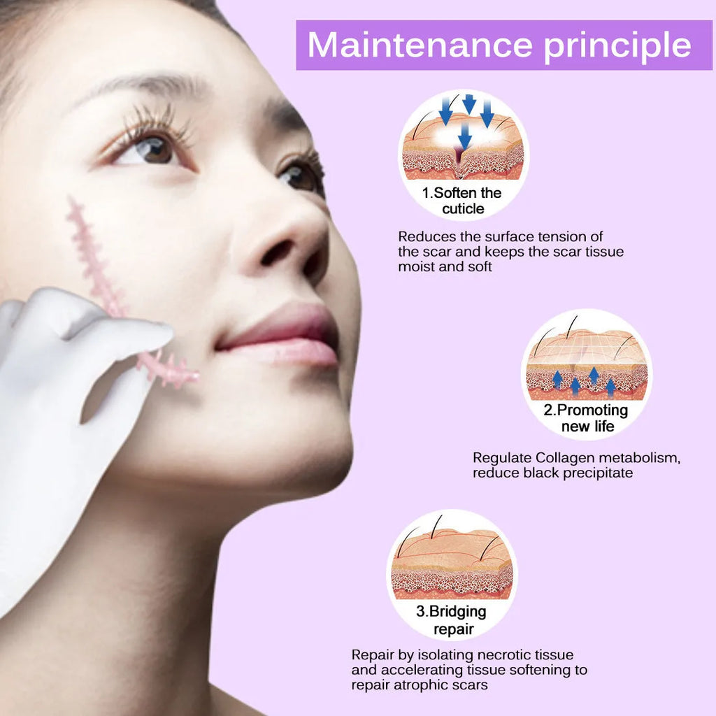 Scar removal cream tube 50g with crocodile peptide extract for face and body scar repair