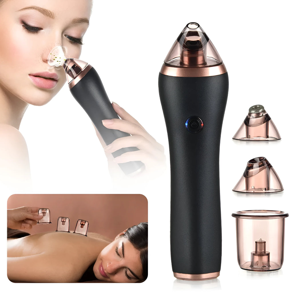 4 in 1 guasha cupping blackhead remover machine with suction heads and USB cable