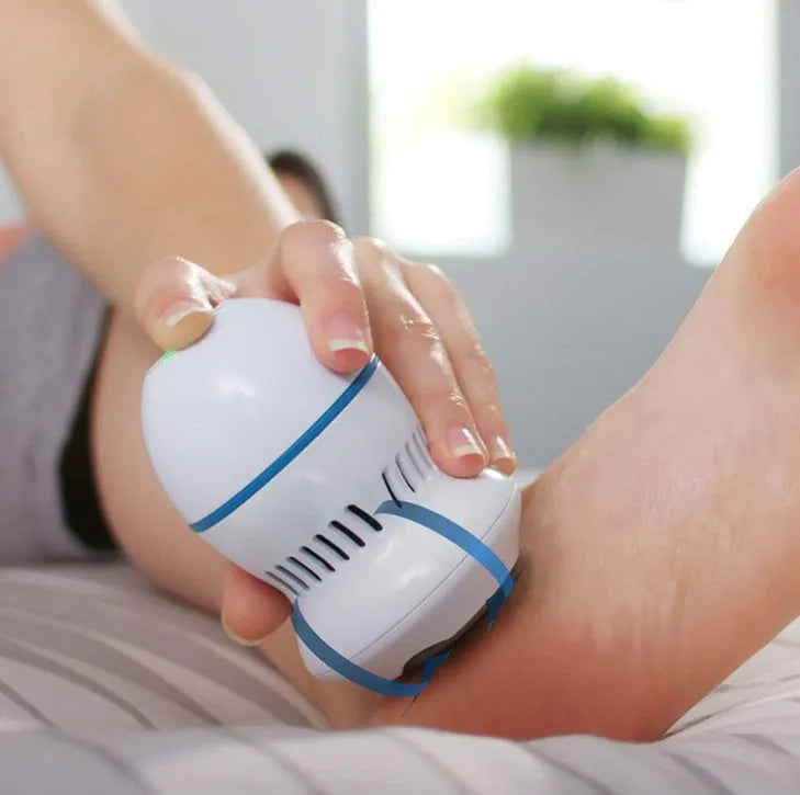 Beige and white USB-charged electric foot file grinder with vacuum system and two diamond grinding heads.