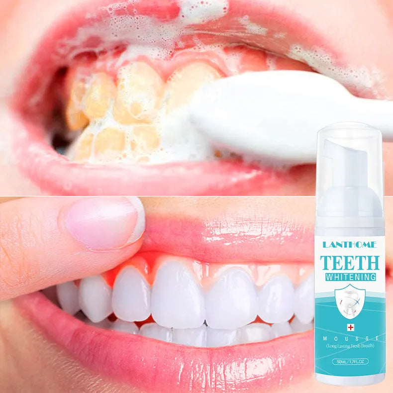 Teeth whitening mousse 50ml oral cleaning foam in white bottle with blue label