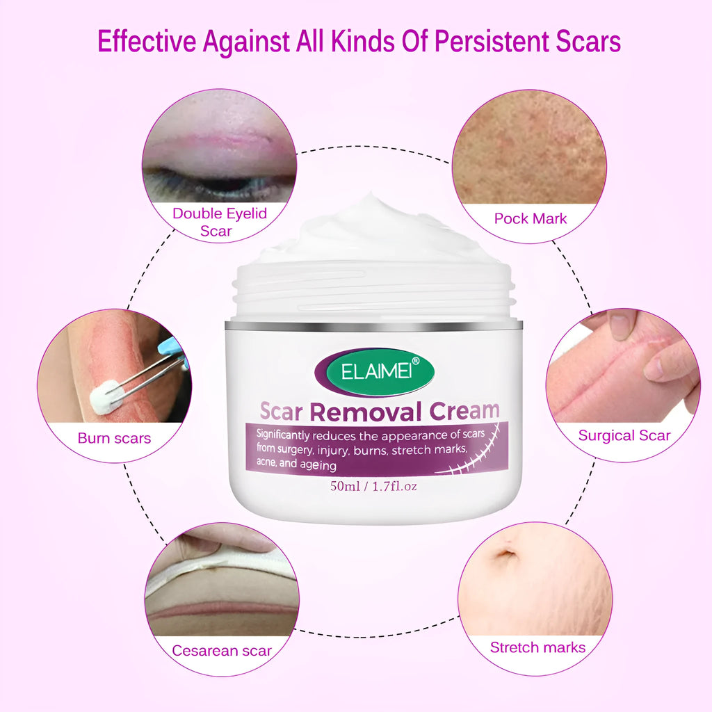 Scar removal cream tube 50g with crocodile peptide extract for face and body scar repair