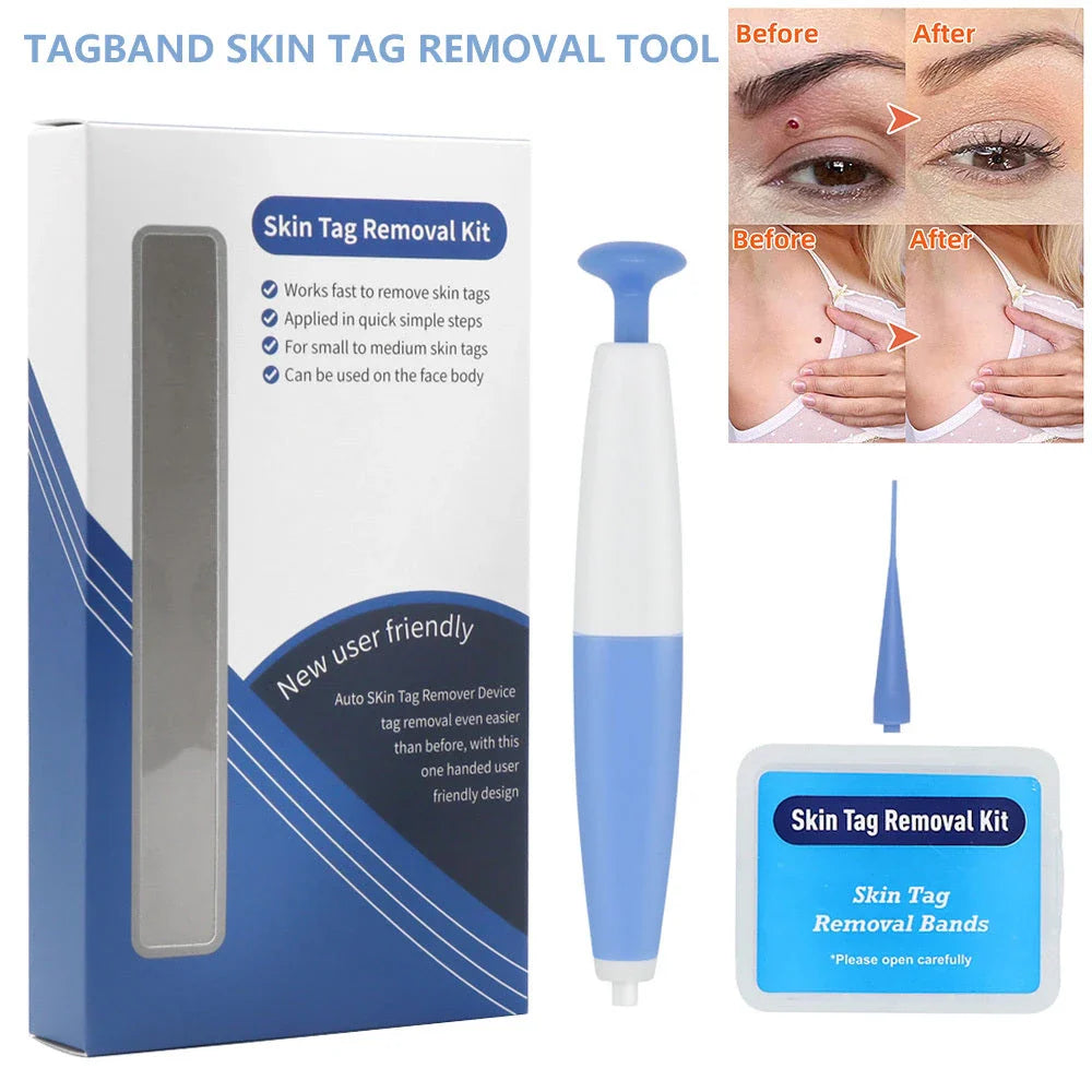 Premium skin tag remover tool with micro-band technology for safe and painless at-home skin tag treatment