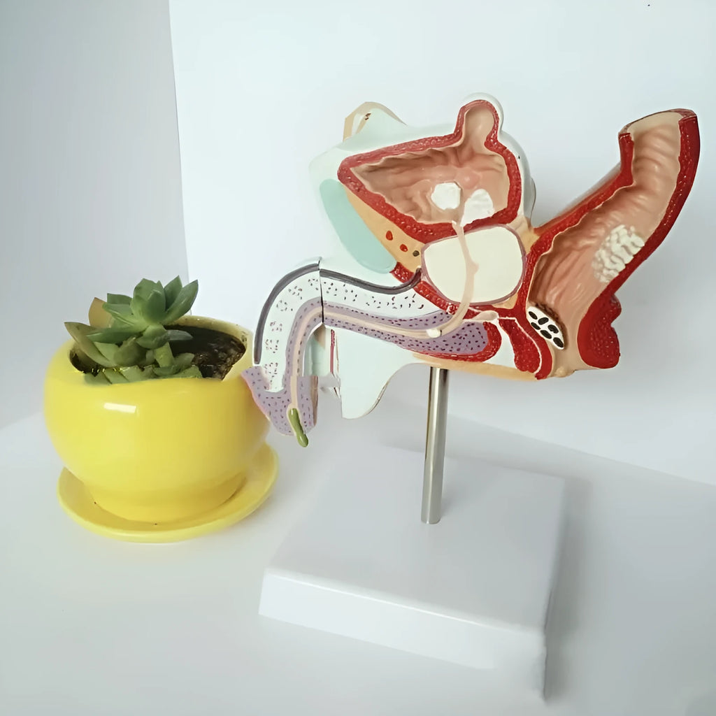 Anatomical male reproductive system pathology model showing detailed disease structures