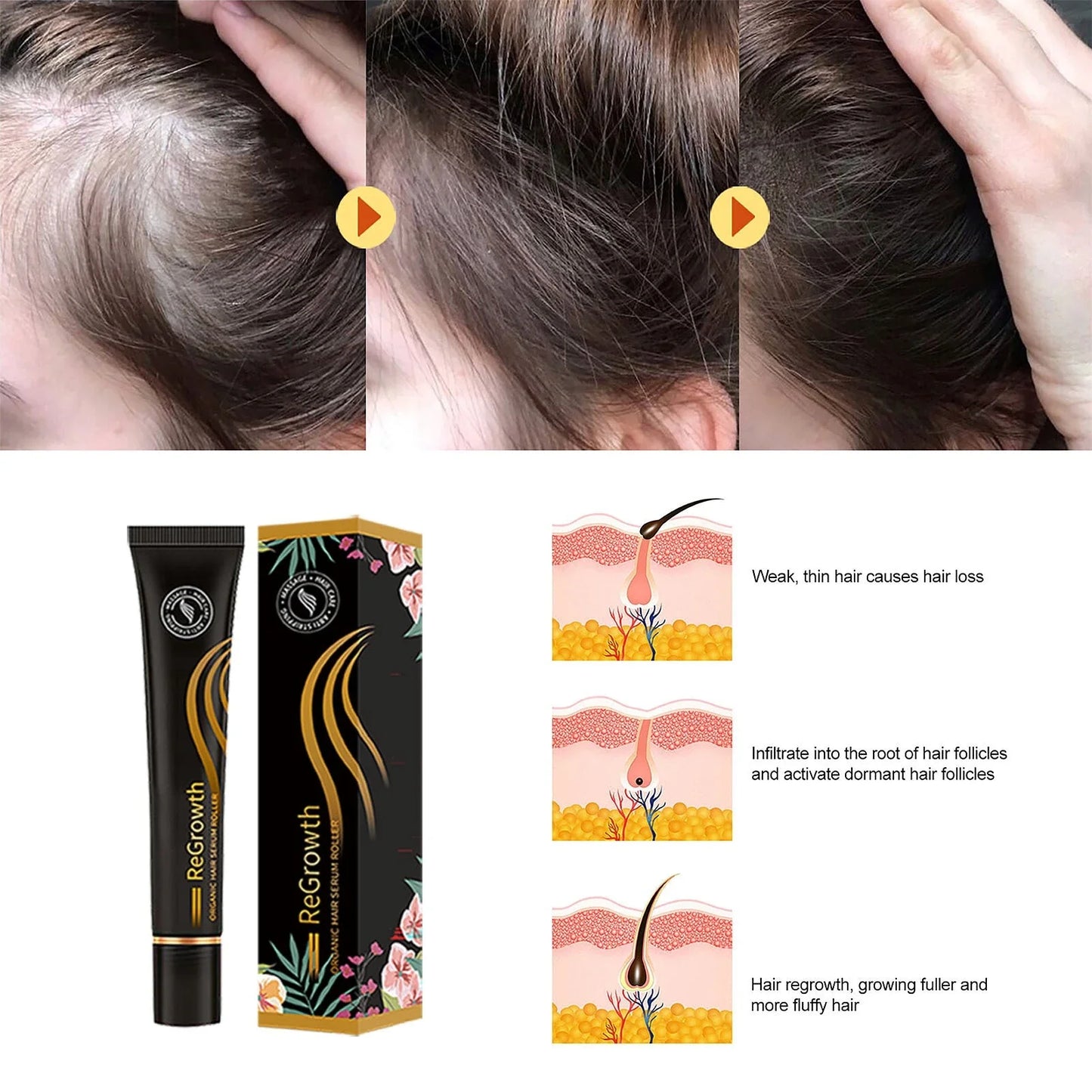 Organic Hair Regrowth Serum with Massage Roller for Nourishing Scalp and Promoting Healthy Hair Growth