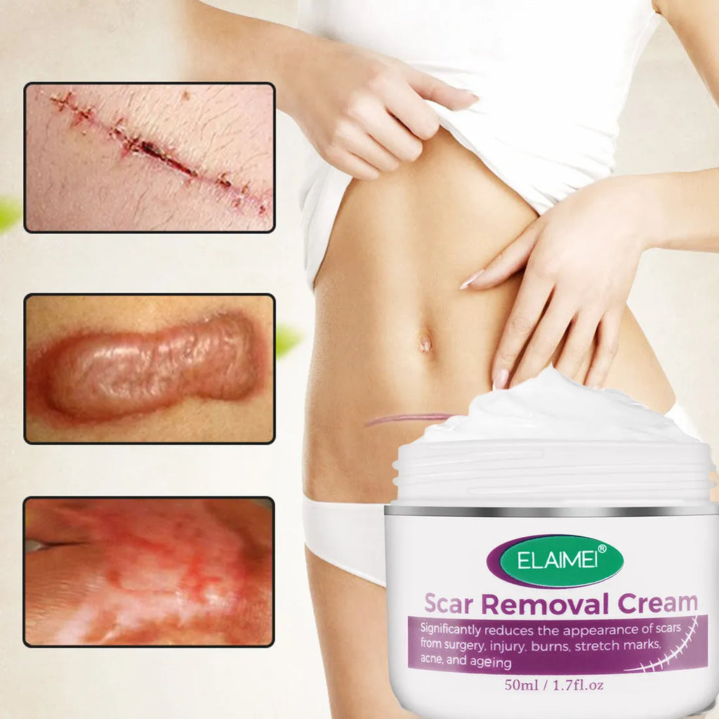 Scar removal cream tube 50g with crocodile peptide extract for face and body scar repair