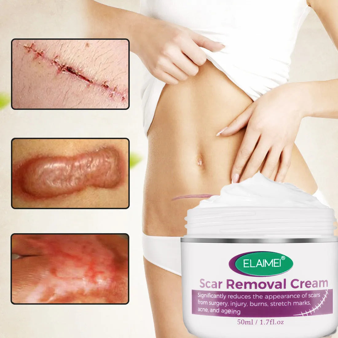 Scar removal cream tube 50g with crocodile peptide extract for face and body scar repair