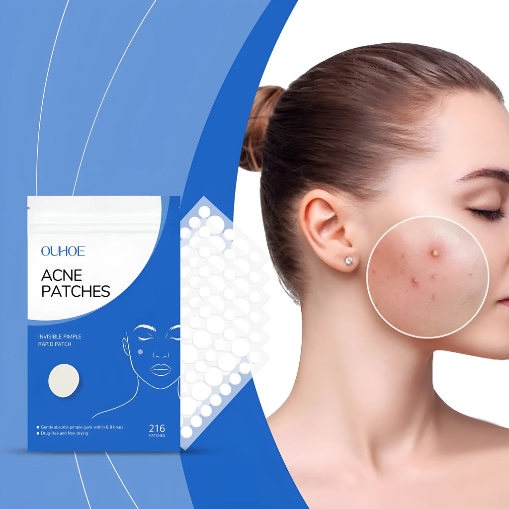 216-count acne patches with tea tree oil and vitamin E for facial blemish care