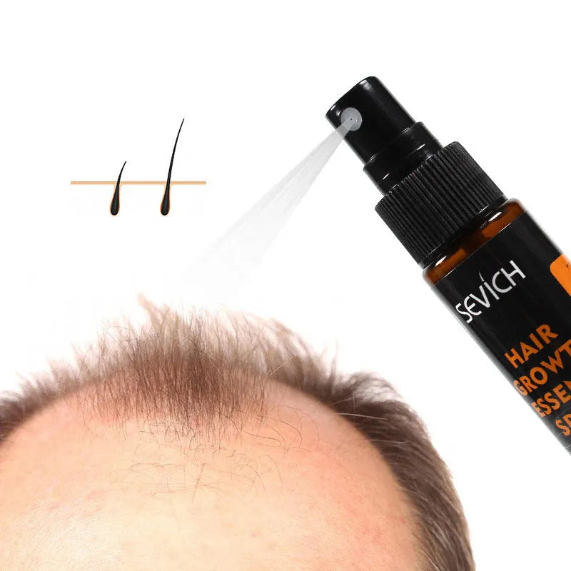 Anti-drop hair lotion 30ml tight hair lotion black colour for scalp and hair root care