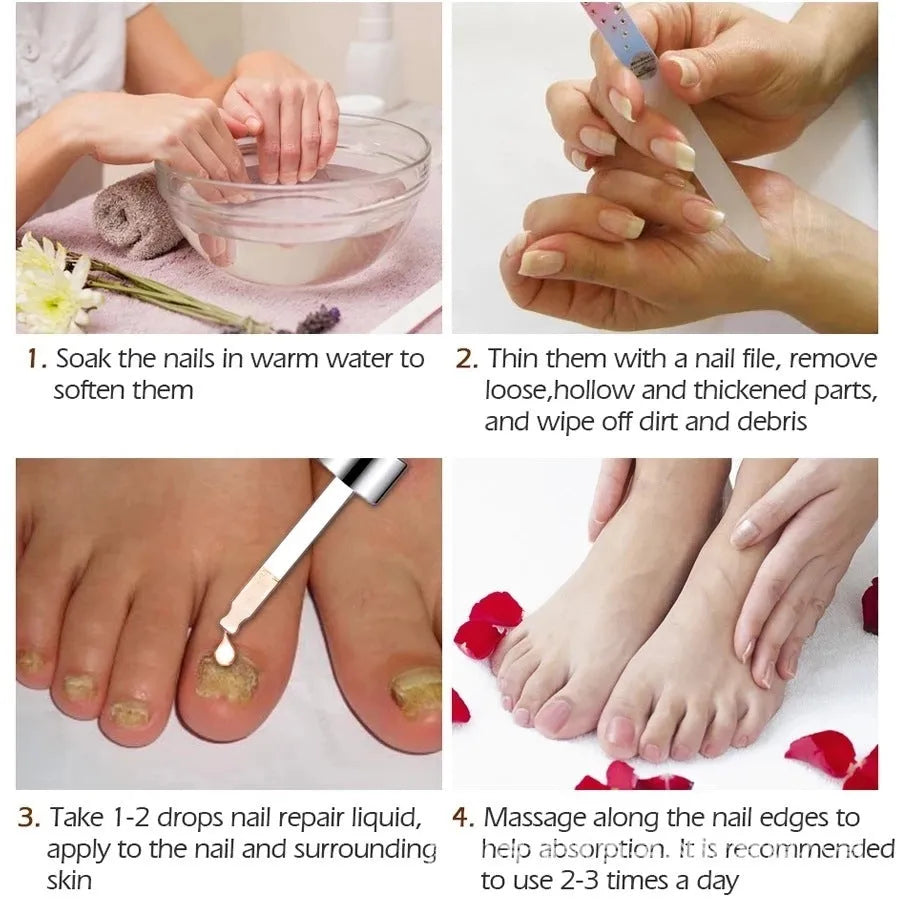 Repair Dust For Deck Liquid Antimicrobial Of Jiagou 10ml foot treatment bottle