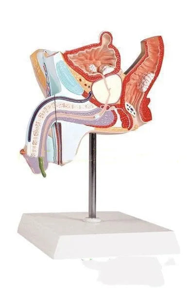 Anatomical male reproductive system pathology model showing detailed disease structures