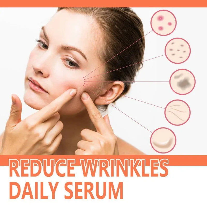 30ml bottle of rose essential oil for skin care, targeting fine wrinkles, brightening and firming.