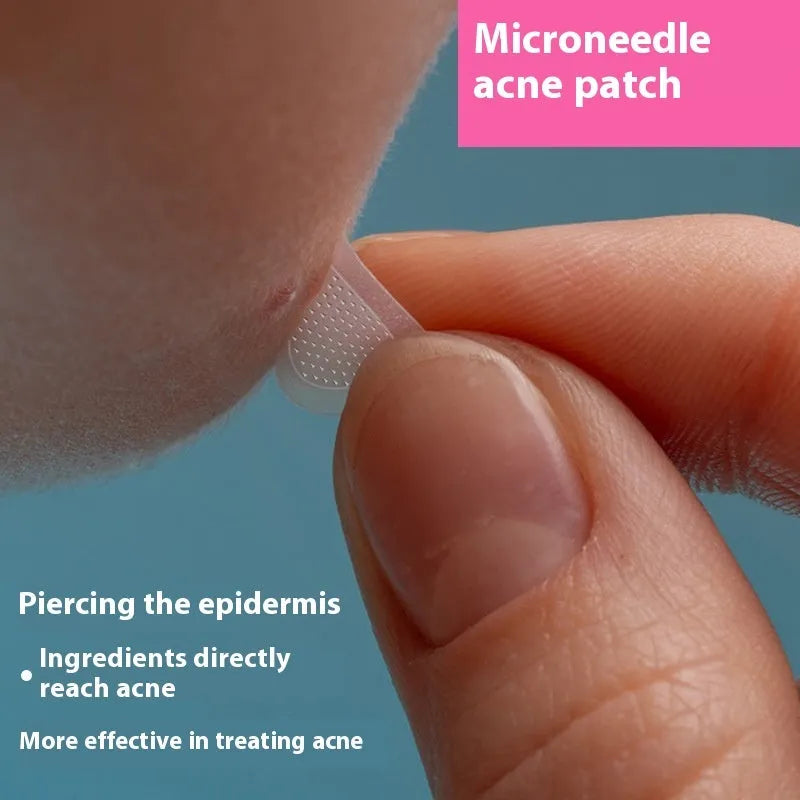 Soluble hyaluronic acid invisible microneedle acne patch sheet with 9 individual 14mm patches.