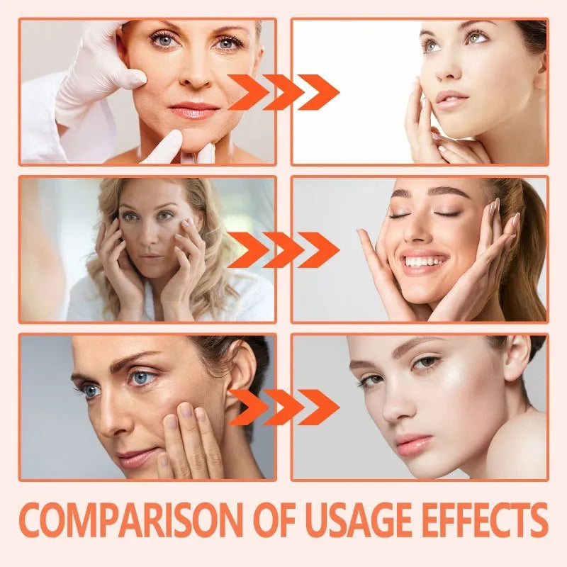 30ml bottle of rose essential oil for skin care, targeting fine wrinkles, brightening and firming.
