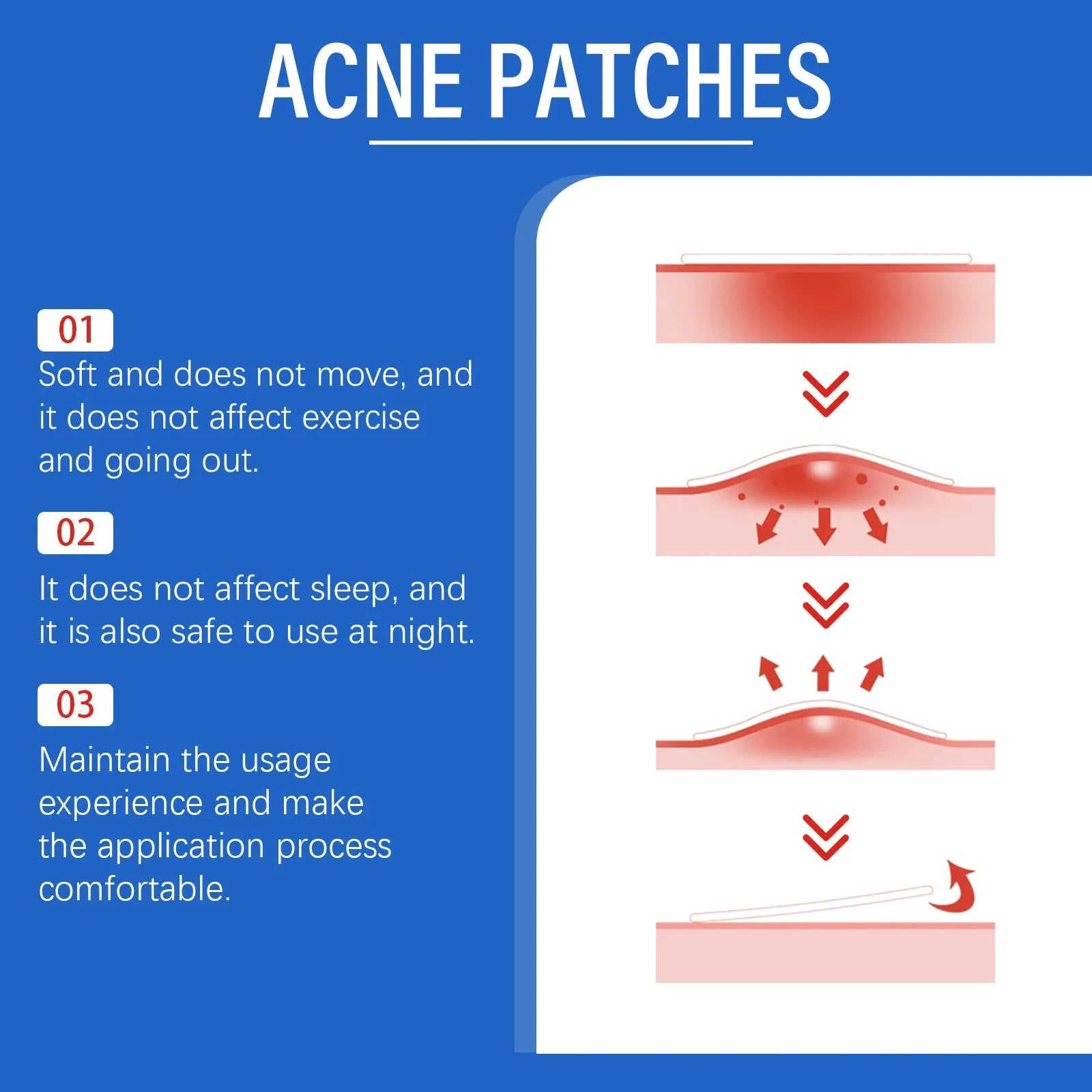 216-count acne patches with tea tree oil and vitamin E for facial blemish care