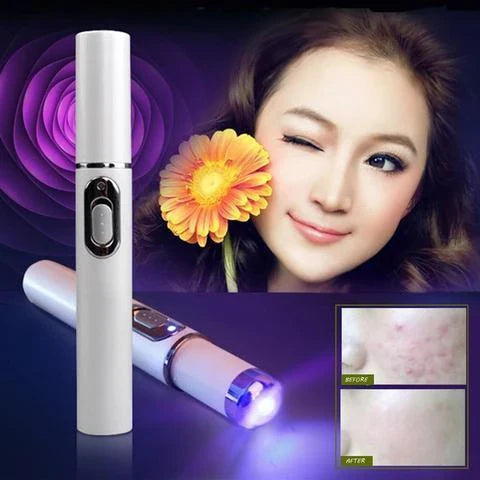 Blue Light Therapy Pen for Treating Acne, Scars, and Wrinkles - Portable Skincare Device with 415nm Blue Light, Heat, and Bio-Electric Current