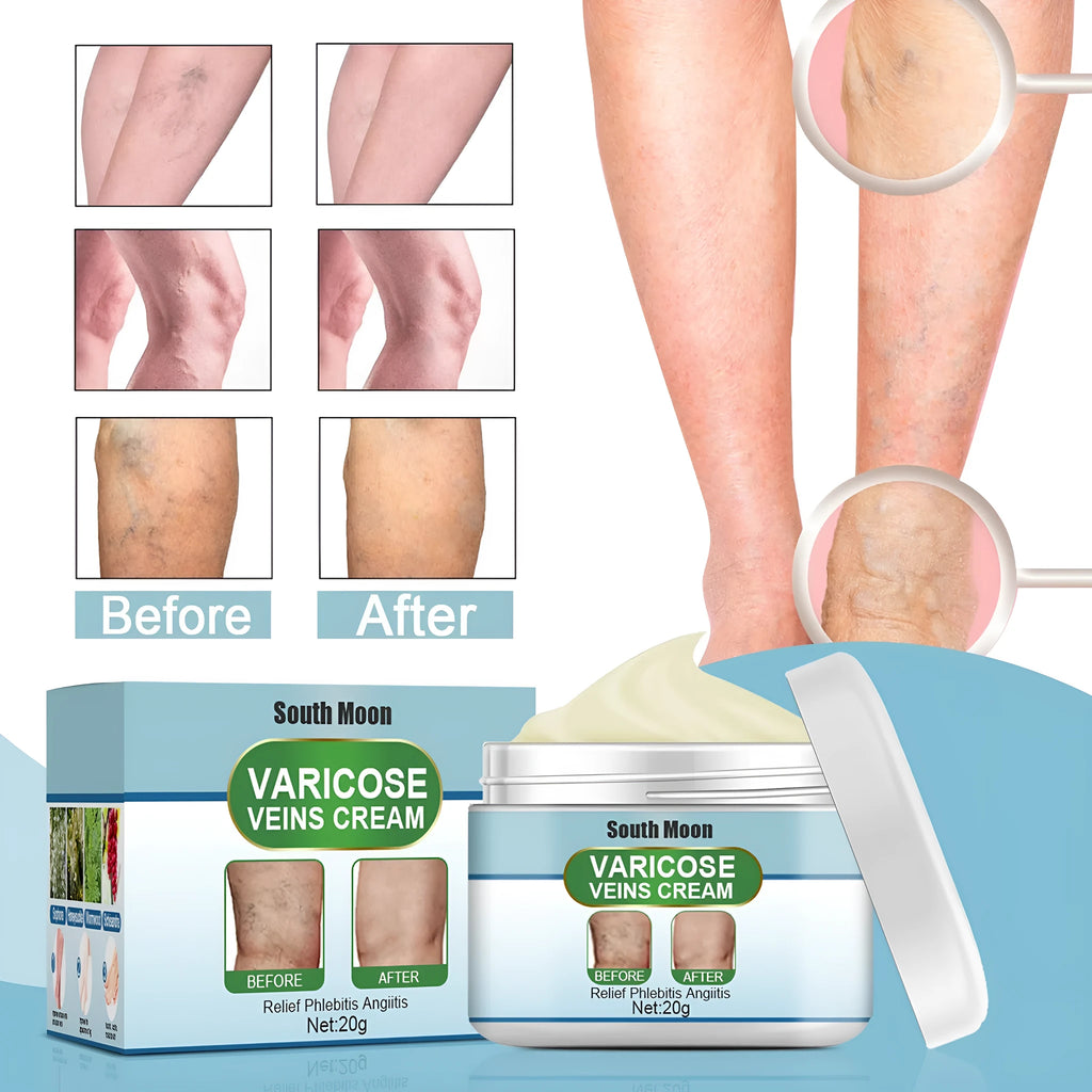 20g jar of vein repair cream for leg vein relief and visible blue-green vein reduction