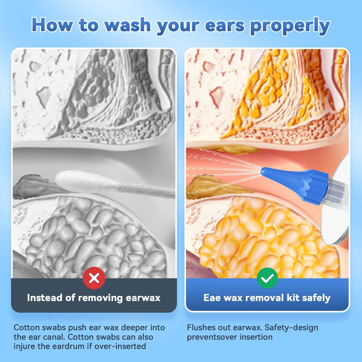 E20 Blue portable manual ear wash tool with water basin, one-hole nozzles and five-hole nozzle on host
