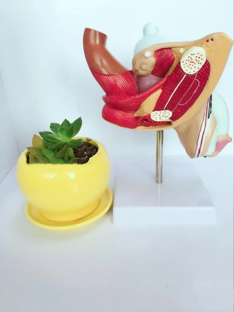 Anatomical male reproductive system pathology model showing detailed disease structures