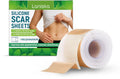 Silicone scar sheets roll measuring 4cm wide by 150cm long with tea tree oil and aloe extract ingredients