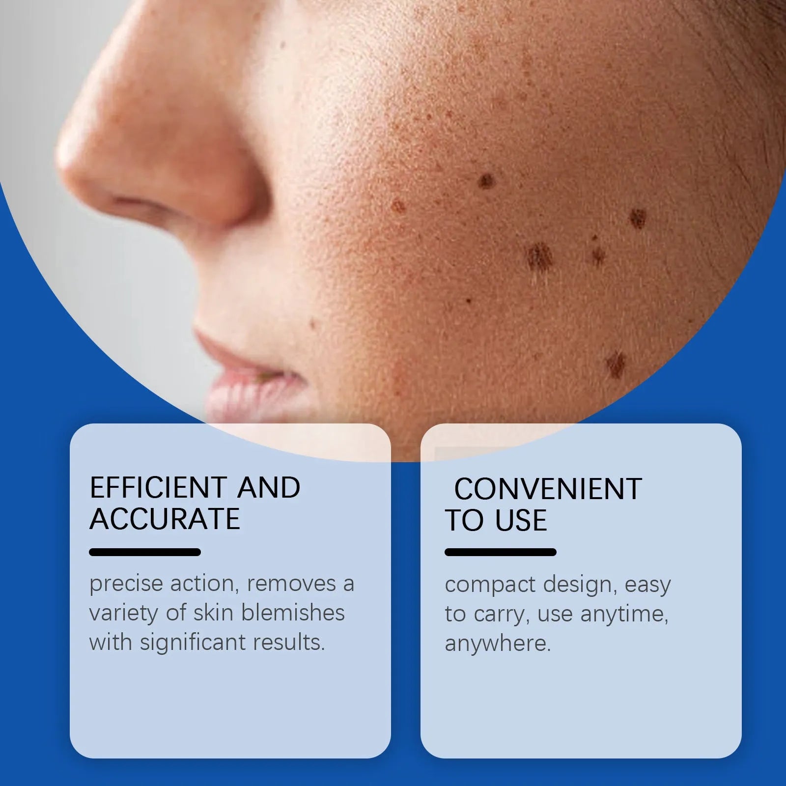 A handheld white ABS plastic laser pen device for removing moles and warts.