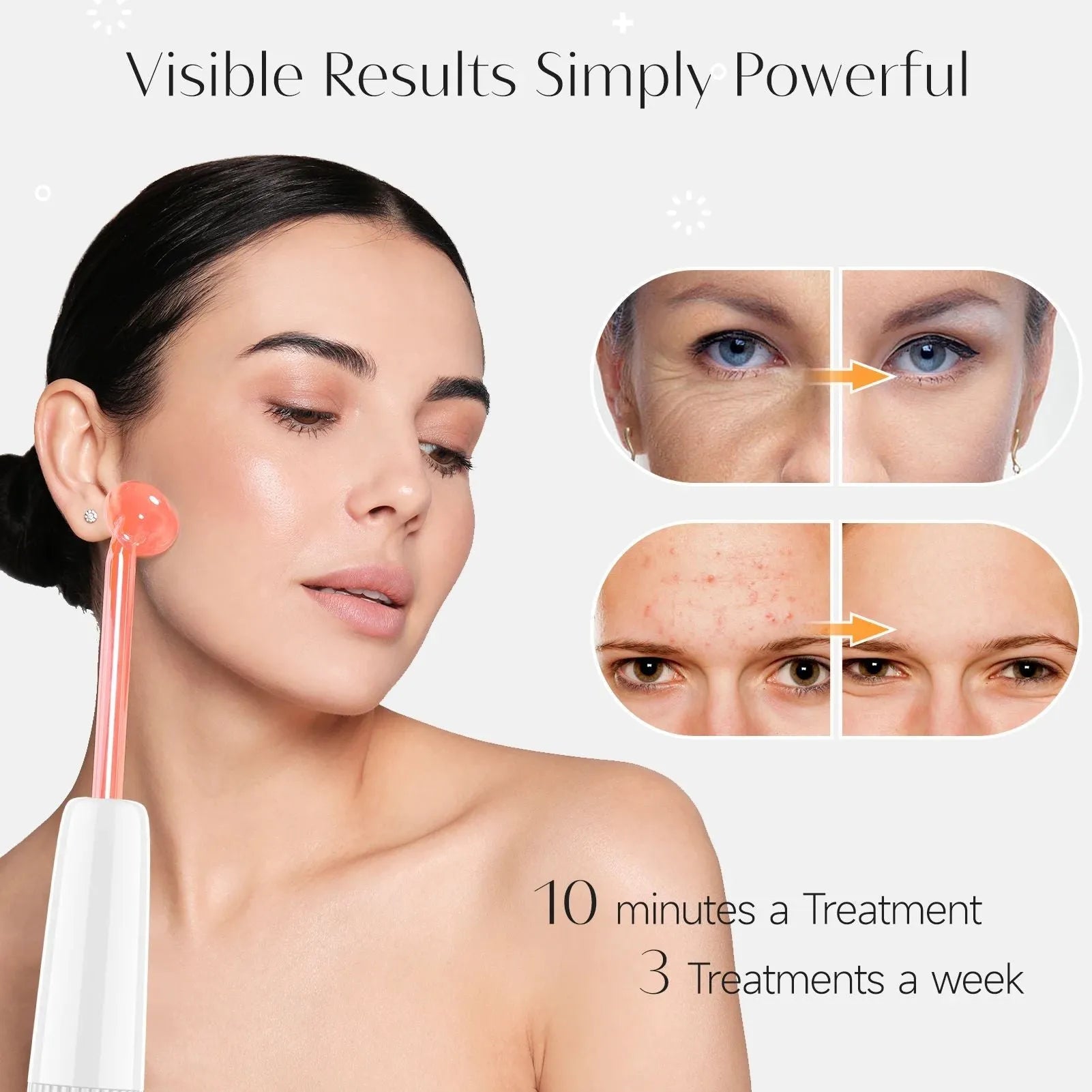 High frequency electrode magic wand machine with blue neon light, space capsule design, and EU Plug for acne mark removal