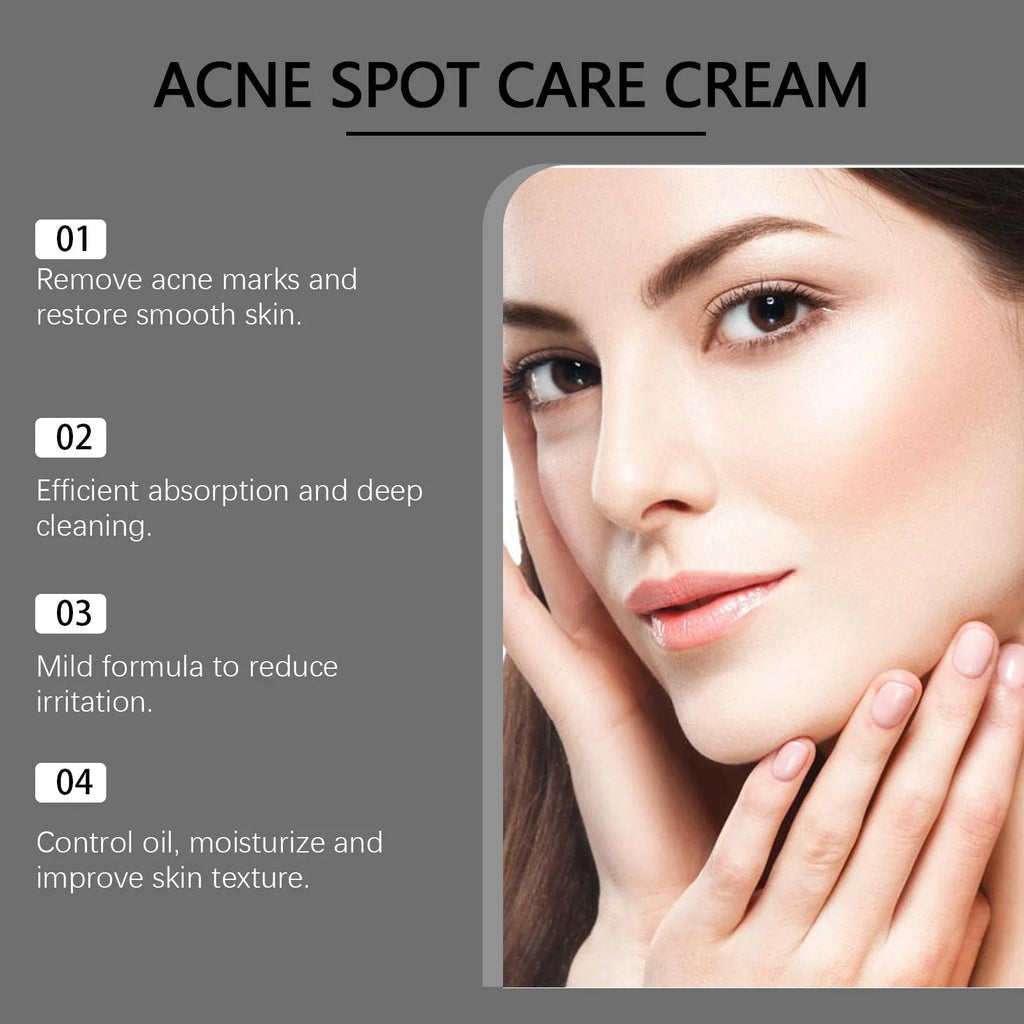 15g tube of mild acne treatment cream with mint, tea tree oil and aloe leaf ingredients