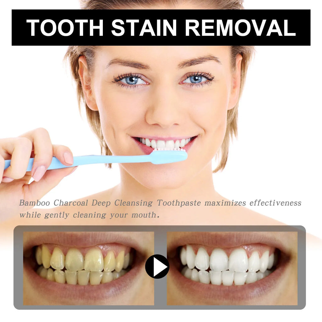 30ml bamboo charcoal bright white stain removing toothpaste tube