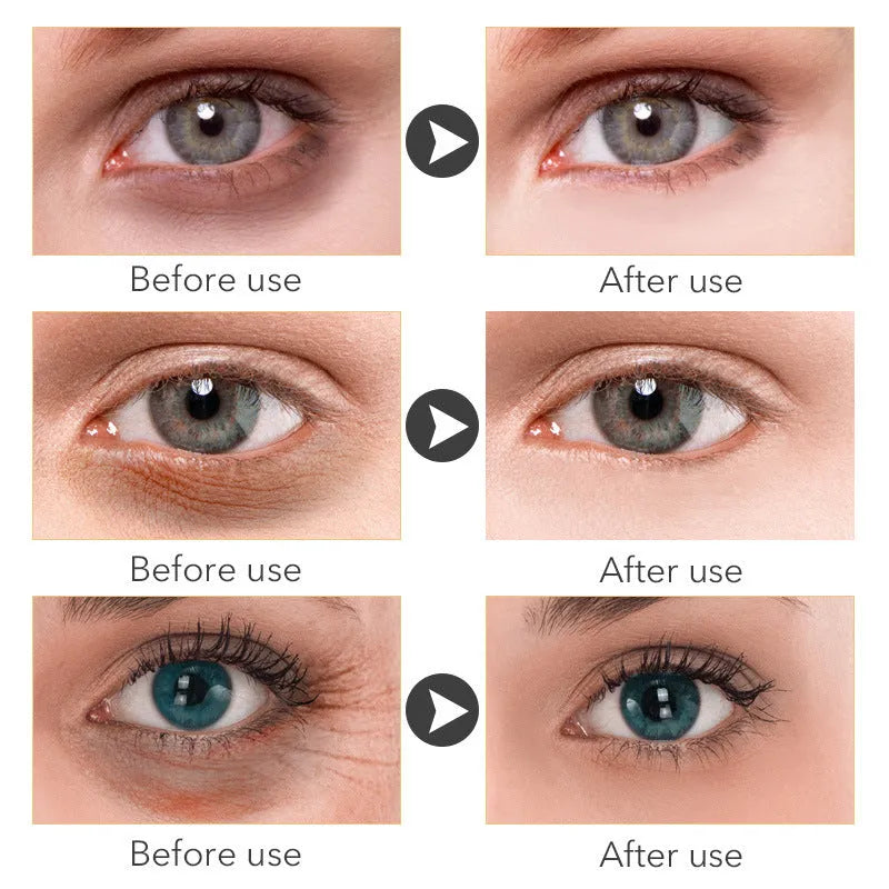 30ml pump bottle of Beauty Eye Cream for women's eye contour skincare