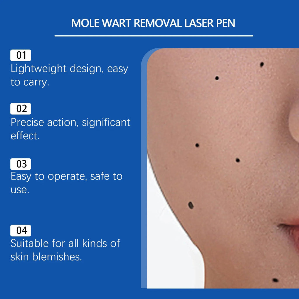 A handheld white ABS plastic laser pen device for removing moles and warts.