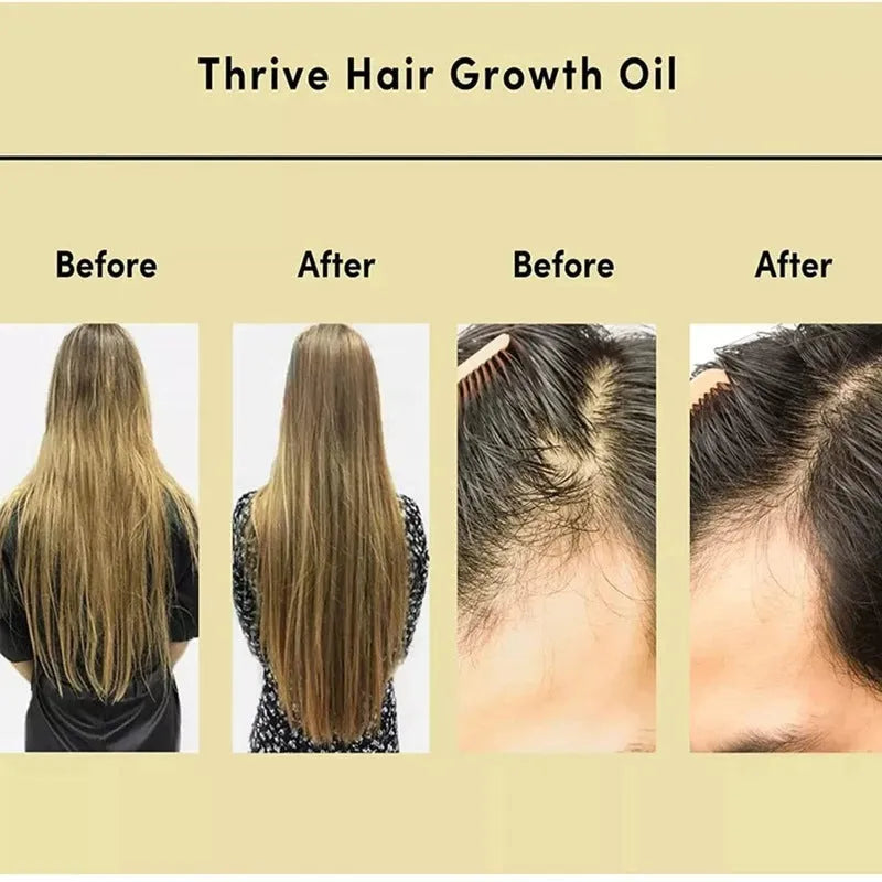 Yellow 60ml bottle of rosemary essential oil for hair care treatment