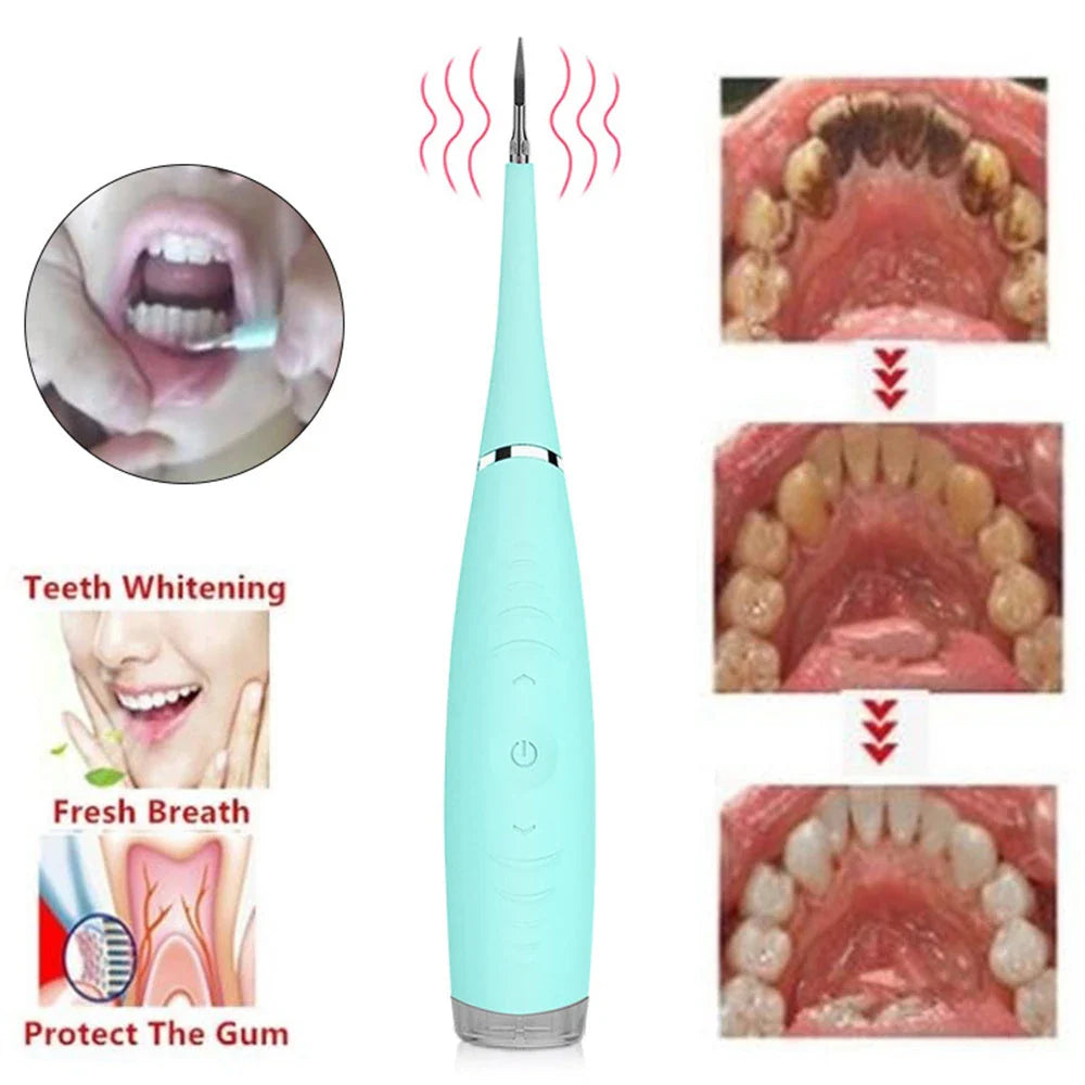 Powerful electric toothbrush with high-frequency vibration and physical calculus removal for deep dental cleaning