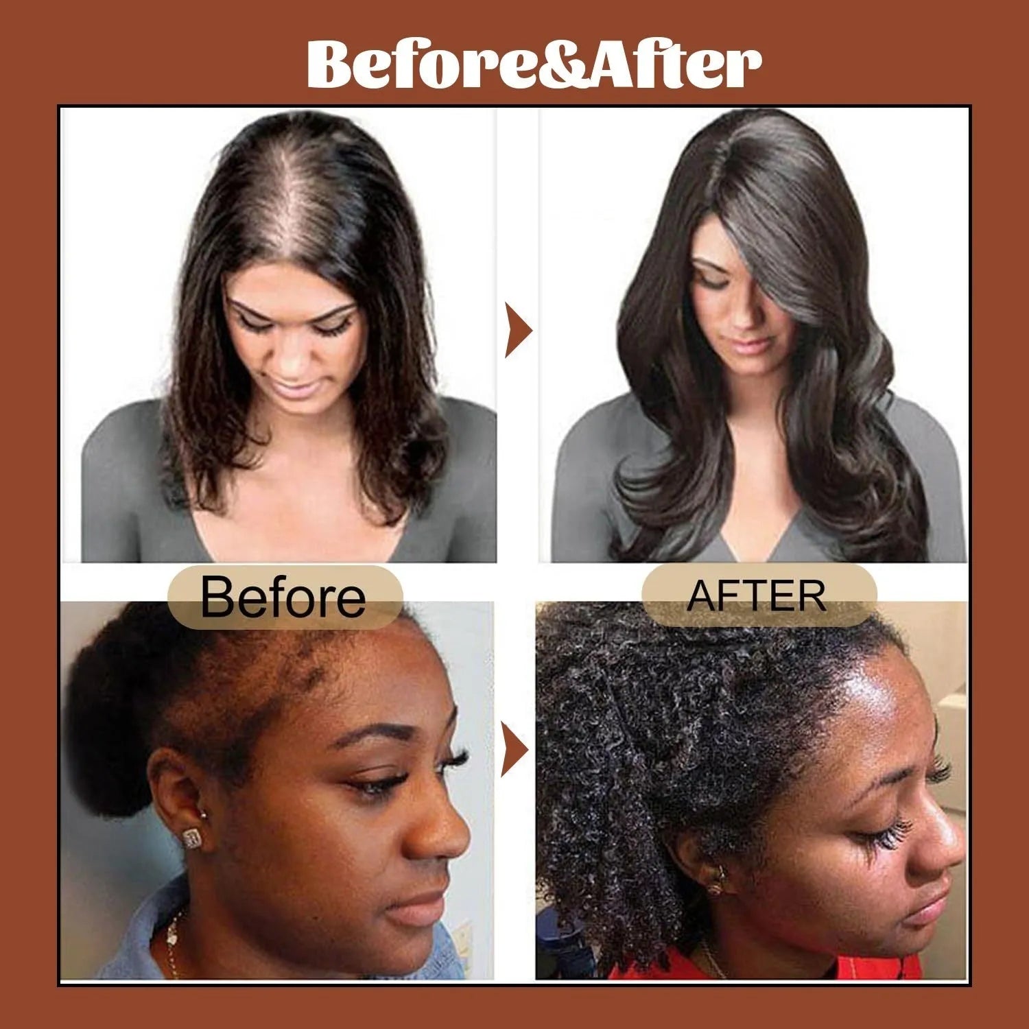Hair oil bottle 120g for hair growth and anti hair loss with frizz control