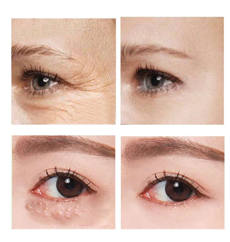 30ml pump bottle of Beauty Eye Cream for women's eye contour skincare