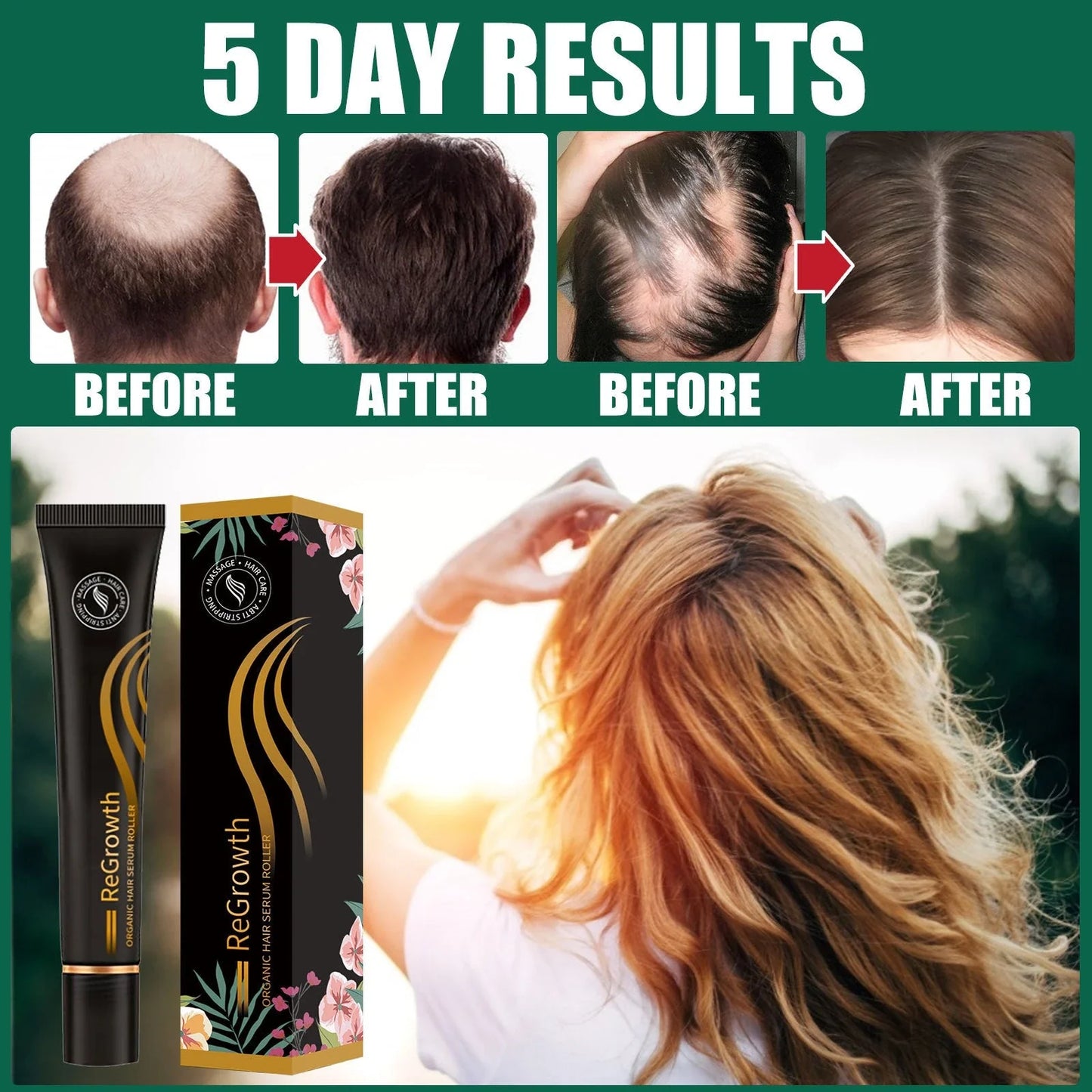 Organic Hair Regrowth Serum with Massage Roller for Nourishing Scalp and Promoting Healthy Hair Growth